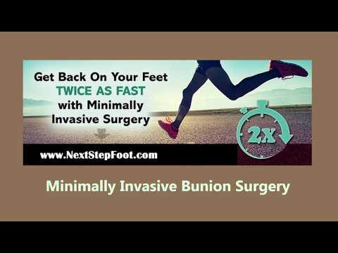 Minimally Invasive Bunion Surgery Patient Testimonial
