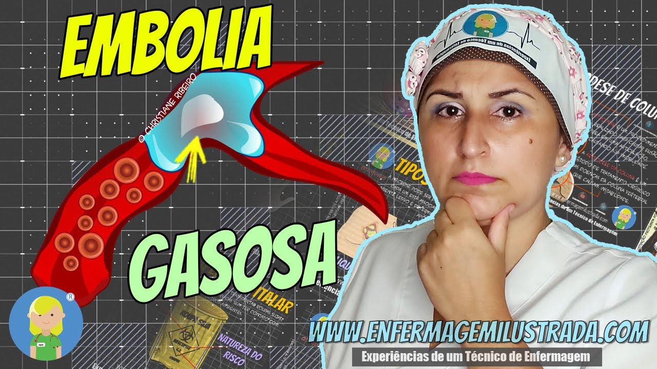 A Embolia gasosa: Como ocorre?