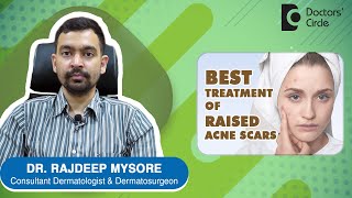 How to treat raised acne scars? - Dr. Rajdeep Mysore | Doctors