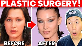 BELLA HADID Cosmetic Surgery Transformation!