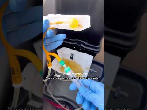 Urinary catheter removal. #nursing #nurse #urinarycatheter