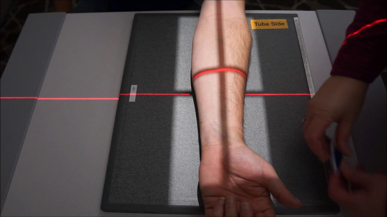 FOREARM AP and Lateral