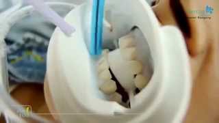 preview picture of video 'Teeth whitening - Winning Smiles Dental Surgery In Blacktown Nsw Australia'