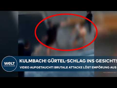KULMBACH: Mit Gürtel ins Gesicht geschlagen! Video von brutaler Attacke löst Empörung aus!