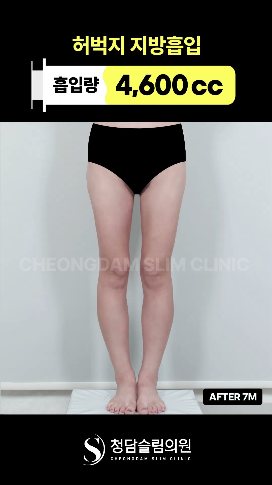 허벅지 고민, 이제 정리할 때? 👀