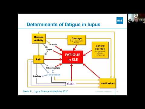 Image - Lupus and Fatigue: What You Should Know