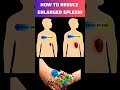 How To Treat Enlarged Spleen | How To Reduced Enlarged Spleen #spleen