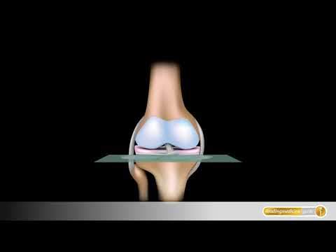 Bandage am Handgelenk verstellbar med w-244 Geschwollene Lymphknoten im Hals der Behandlung des Kindes