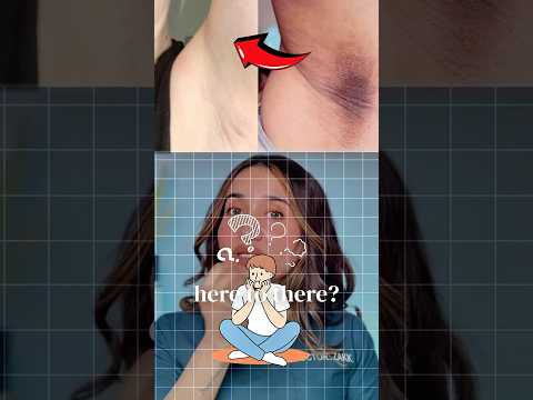 Dark underarms permanent solution !