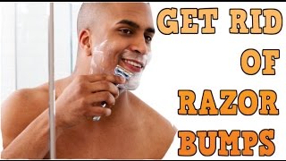 10 Home Remedies to Get Rid Of Razor BUMP | How to Get Rid of Razor Bumps