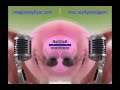 Klaskyklaskyklaskyklasky Gummy Bear In Fast Voice V2