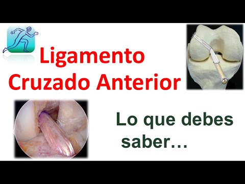 Luxación del Hombro