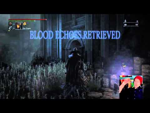 Losing Nearly 4 Million Blood Echoes