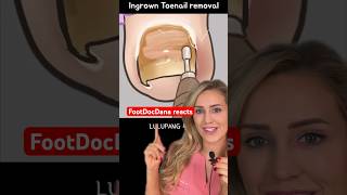 Download lagu Doctor reacts: ingrown nail asmr mp3