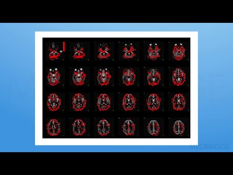 How Pain Works - Adriaan Louw | MedBridge