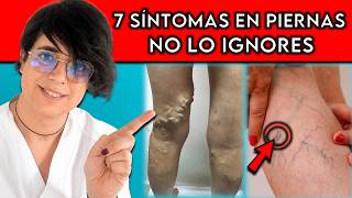 7 SEÑALES en tus PIERNAS que avisan de un ÓRGANO enfermo || ¡No lo ignores!