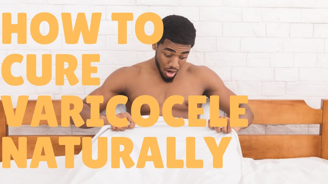 How to cure varicocele naturally ?