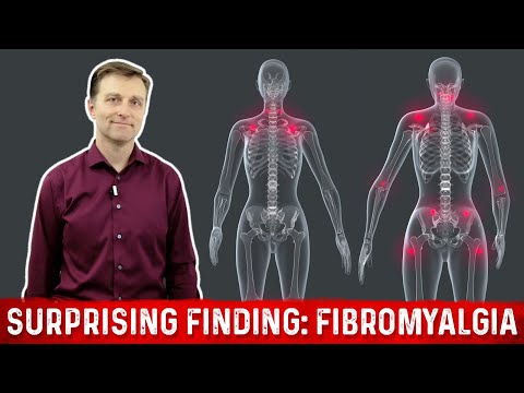 What is Fibromyalgia – Surprising Finding Explained by Dr. Berg