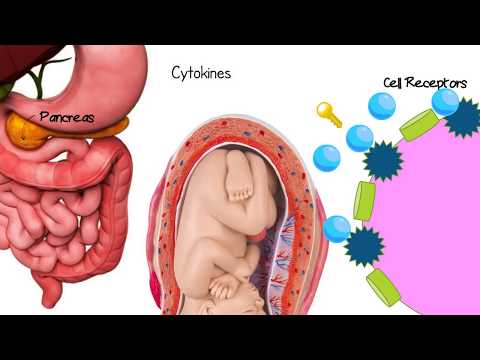 What is Gestational Diabetes (Animation)
