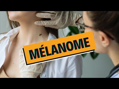 Mélanome