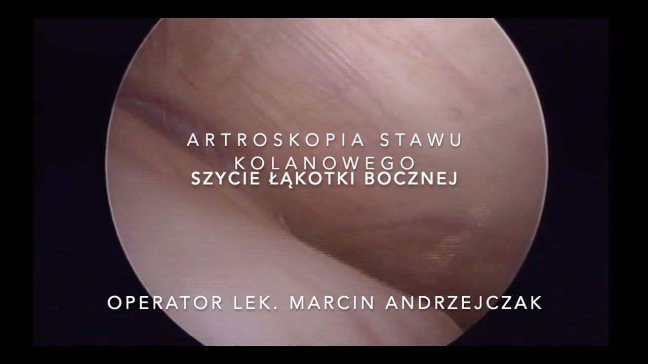 Marcin Andrzejczak-6
