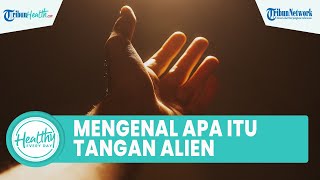 Apa itu Tangan Alien? Tangan Bergerak Sendiri hingga Sulit Dikendalikan, Ini Penyebab & Cara Atasi
