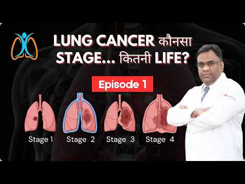 Lung Cancer Ki Stage Pe Depend Karta Hai — Surgery Hogi Ya Chemotherapy? | Dr. Belal