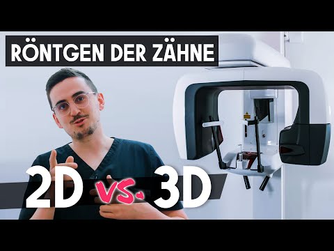 360° Röntgen der Zähne! Wir schauen ganz genau hinein.