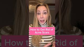 How to get rid of acne scars and redness #dermatologist #acne #acnescars #skincare