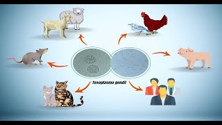 Diagnosis snd Treatment Toxoplasmosis