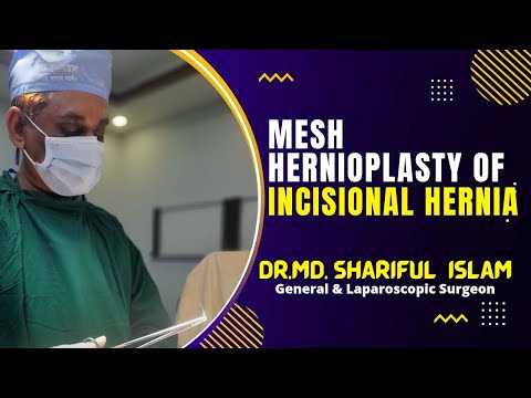 Mesh Hernioplasty of Incisional Hernia || Dr. Md. Shariful Islam