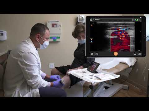 Knieschmerzen mit Knienervenblockade