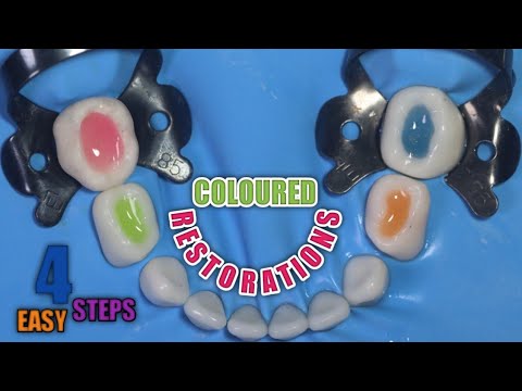 Coloured Restorations in Pediatric Dentistry | 4 Steps