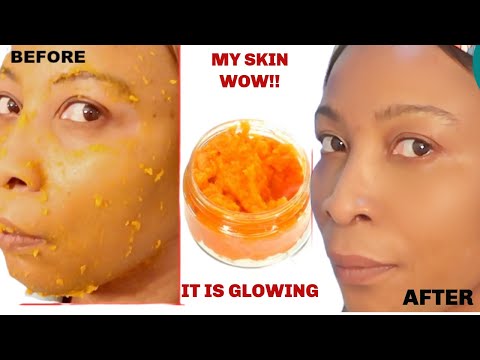 , title : 'I USE POTATO AND PAPAYA ON MY SKIN, LOOK WHAT IT DID TO MY SKIN!! CLEAR DARK SPOTS AND WRINKLES'