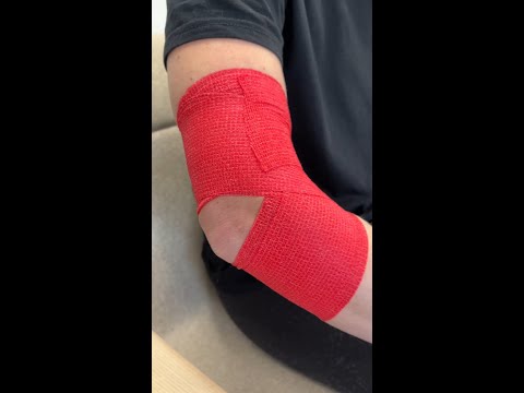 Easy Elbow Application to help prevent hyperextension