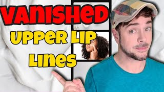 How To Get Rid Of Lip Lines and Upper Lip Wrinkles | Chris Gibson