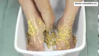 Home Remedies for Cracked Heels