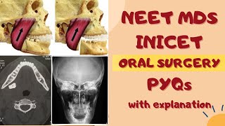 Previous year MCQs with explanation ( PART6) || Oral Surgery || Neet MDS ||