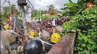 ഒരു വയസുകാരിക്ക് അനസ്‌തീഷ്യ നൽകിയതിൽ വീഴ്ച? കണ്ണൂര?