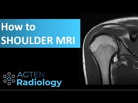 How to Assess Shoulder MRI