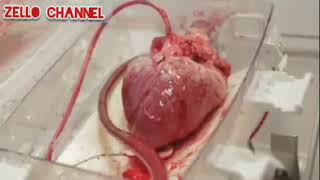 Download lagu Detak jantung sound effect mp3