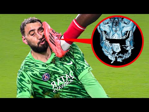 Most DANGEROUS Injuries in Football