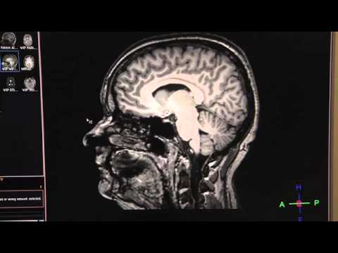 創傷後應激障礙紀錄片 (PTSD Documentary)