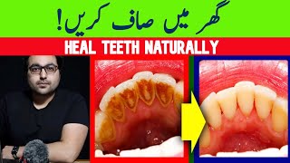 Dr. Zee:Natural Remedy for dental Plaque, Cavities, and Gingivitis