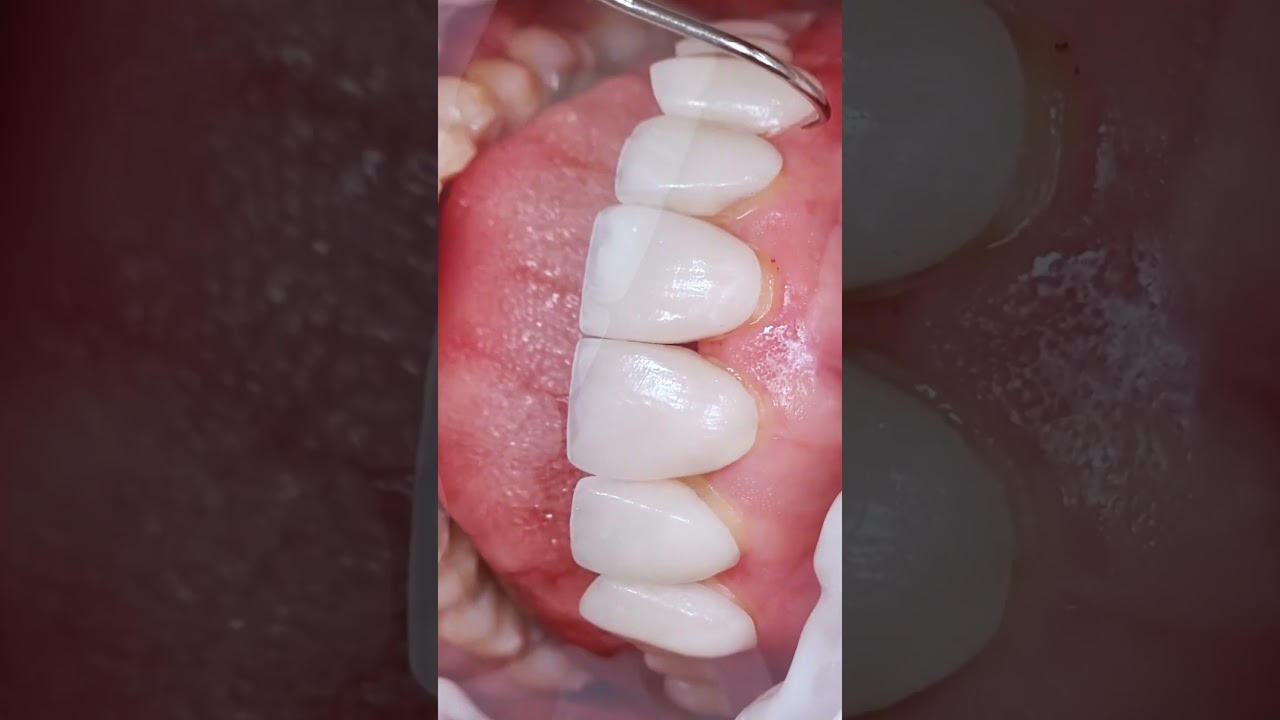 Daniel Perez Parcero-19