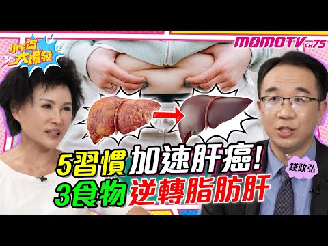5習慣加速肝癌!! 3食物「逆轉脂肪肝」 feat.譚敦慈 錢政弘 醫師【 小宇宙大爆發 】