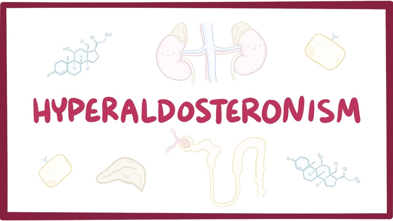 Hyperaldosteronism - causes, symptoms, diagnosis, treatment, pathology - YouTube