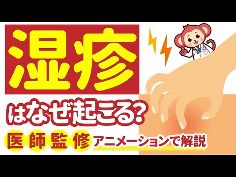 鳥の足皮膚炎 - 原因、症状、治療