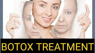 Download Lagu Botox Treatment for Face Wrinkles | Dr Sham Sunder Goyal MBBS MD Thumbnail