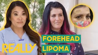 Dr. Lee Performs LIFE-CHANGING Surgery To Remove A Forehead Lump! | Dr. Pimple Popper